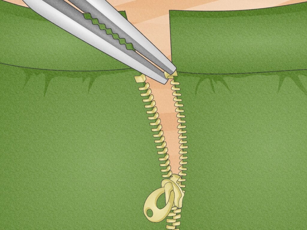 How to Repair a Broken Zipper or Loose Boning Quickly